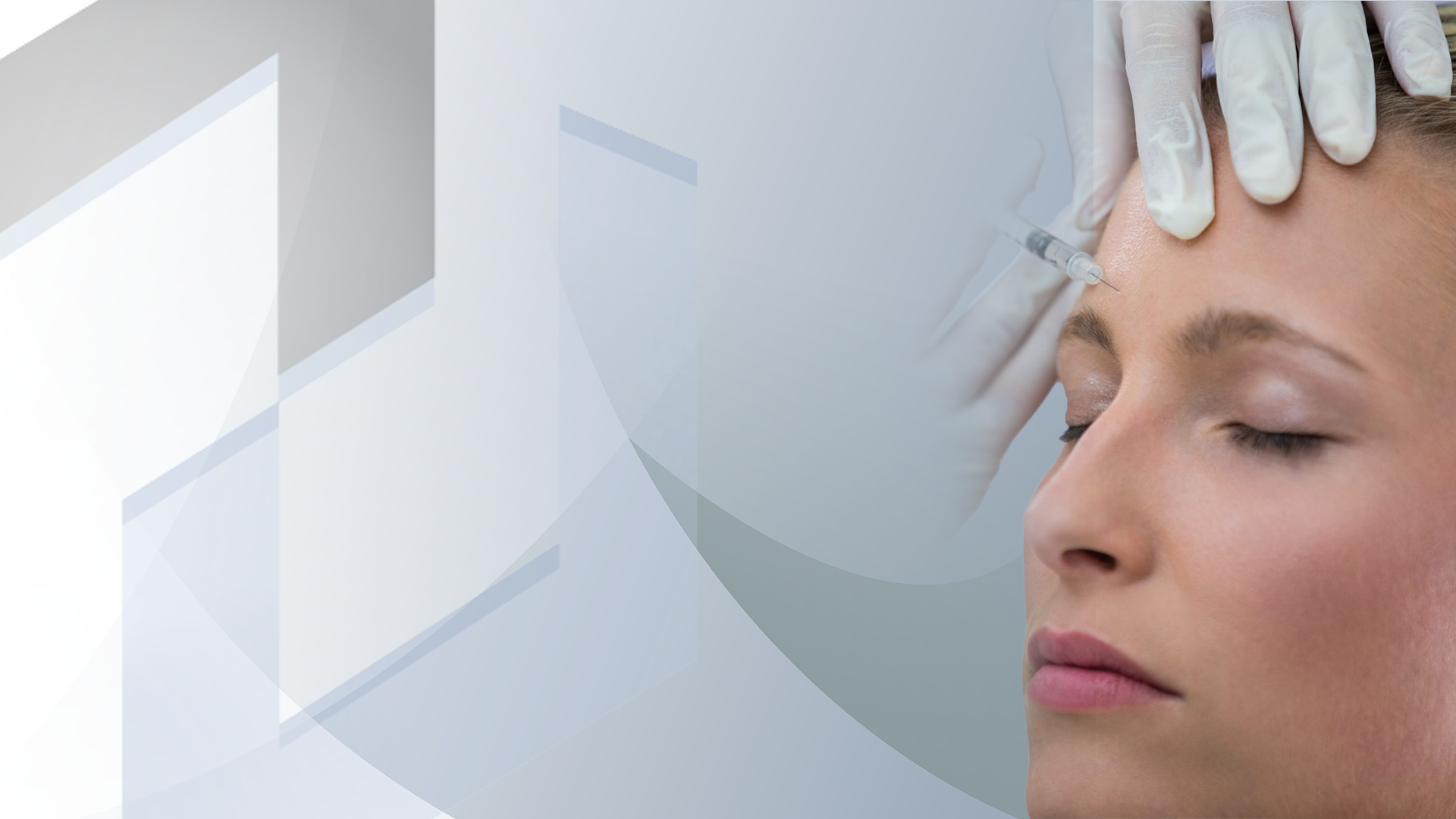 Botox Düsseldorf - Behandlung von mimischen Falten